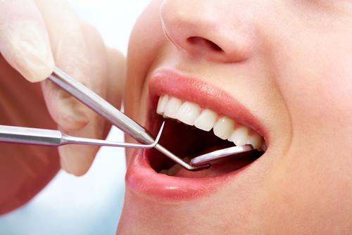 Trường hợp nào nên tiến hành nhổ răng khôn?