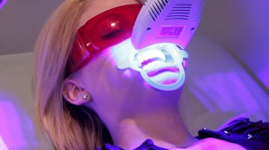 Công nghệ tẩy trắng răng Laser