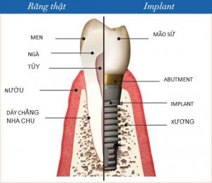 Chức năng của răng giả như răng tự nhiên.