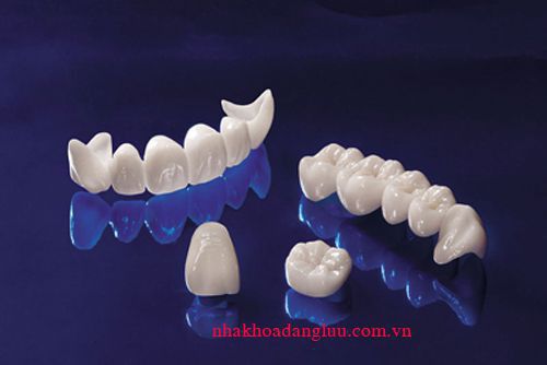 Phương pháp trồng răng vĩnh viễn hiện nay với răng sứ