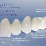 răng sứ cao cấp cercon