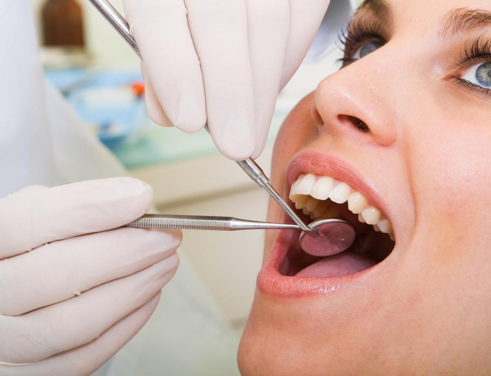 Trám răng thẫm mỹ là gì?