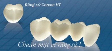 Răng toàn sứ Cercon có độ chính xác, chịu lực tốt, có độ bền dai và tính thẩm mỹ