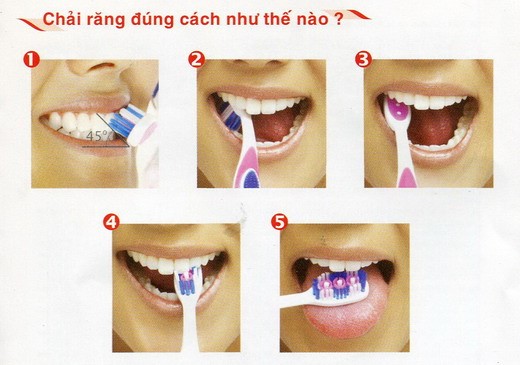 Đánh răng đúng cách bảo vệ sức khỏe răng miệng
