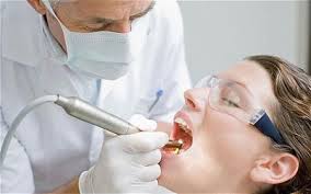 Lời khuyên cho bệnh nhân nhổ răng