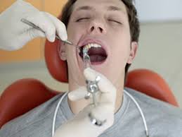 Nhổ răng vĩnh viễn có đau không?