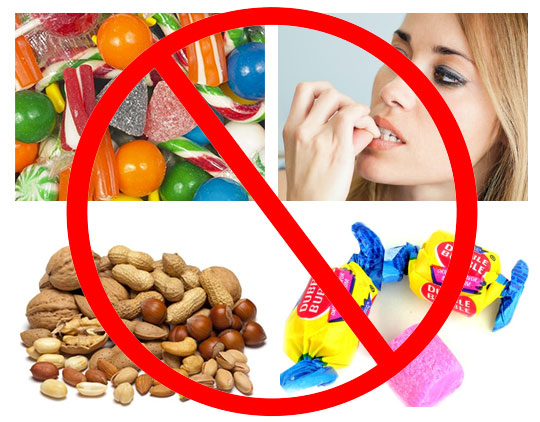Những thực phẩm không nên ăn sau khi niềng răng