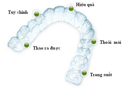 Khí cụ niềng răng tiên tiến không cần mắc cài phổ biến