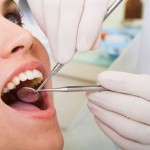 Nhổ răng hàm nhiễm trùng giá bao nhiêu