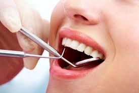 Nhổ răng khôn đem lại nhiều lợi ích
