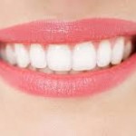 Tẩy trắng răng có tốt không ?