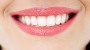 Tẩy trắng răng có tốt không ?