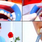 Tẩy trắng răng có giữ được lâu không ?