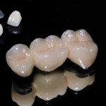 Trường hợp răng bị ố vàng và cách giải quyết