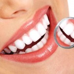 Tại sao nên bọc răng sứ không kim loại?