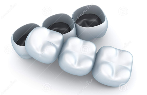 Lựa chọn loại răng sứ chất lượng cao