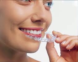 Những cách điều trị tẩy trắng răng