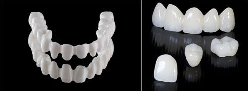 Những ưu điểm của phục hình răng sứ thẩm mỹ