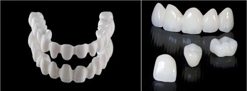 Răng sứ Cercon chất liệu thân thiện với nướu và răng