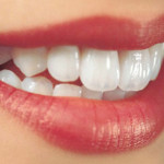 Tẩy trắng răng giúp bạn có một hàm răng trắng
