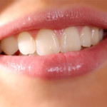 Chúng ta có nên bọc răng sứ thẩm mỹ tại Nha Khoa không?