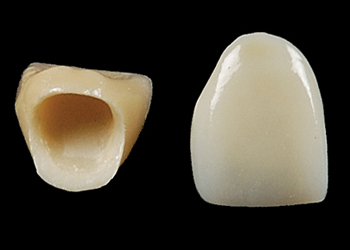 Răng sứ Venus có sườn được làm từ chất liệu zirconia