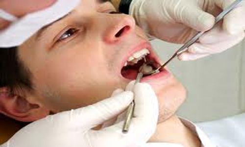 Nhổ răng khôn an toàn tại nha khoa