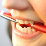 Sự nguy hiểm của chứng nghiến răng và cách điều trị