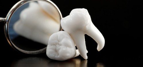 Nhổ răng khôn có nguy hiểm không ?