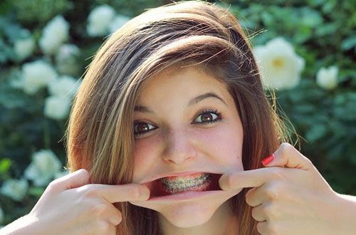 Phụ huynh đã đưa trẻ đi niềng răng để cải thiện hàm răng