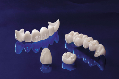 Răng sứ thẫm mỹ đặc biệt  thích hợp với nhiều đối tượng