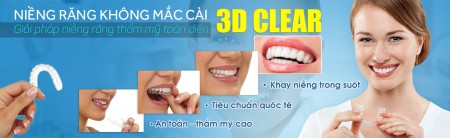 Niềng răng không mắc cài 3D Clear