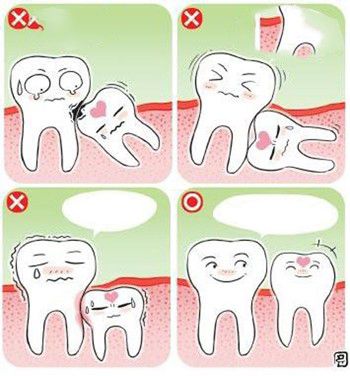 Mọc răng khôn dễ gây tổn thương các răng lân cận