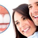 Dán răng sứ veneer cho bạn sở hữu hàm răng trắng đẹp