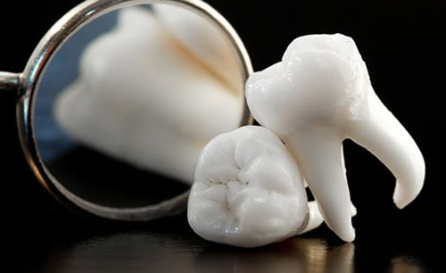Răng khôn là răng số mấy?