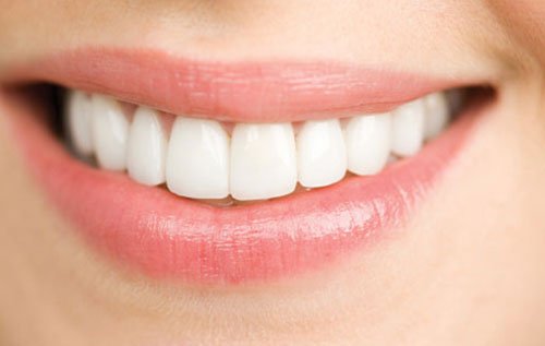 Bọc răng sứ thẩm mỹ được bao lâu – Có phải làm lại không?