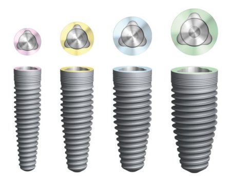 các loại trụ implant tại nha khoa hiện nay