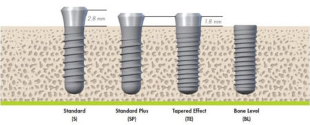 các loại trụ implant tại nha khoa hiện nay