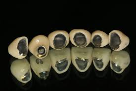 Hình sáng răng sứ tương đối giống với răng thật