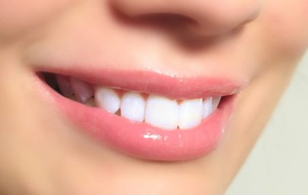 Hàm răng trắng sáng giúp khuôn mặt rạng rỡ hơn