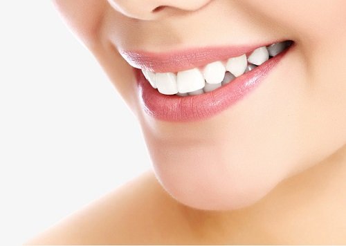 "Tất tần tật" về bọc răng sứ cả hàm cho bạn-1