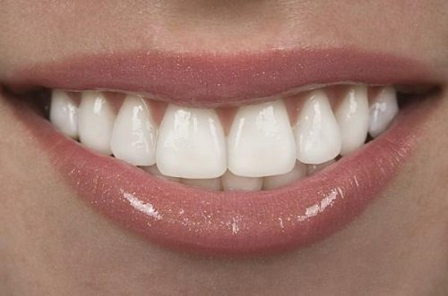 Bọc răng sứ chỉnh hô hiệu quả ra sao sau khi thực hiện?-2
