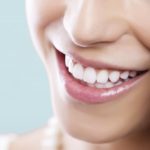 Tác hại của việc tẩy trắng răng thiếu kiến thức nha khoa