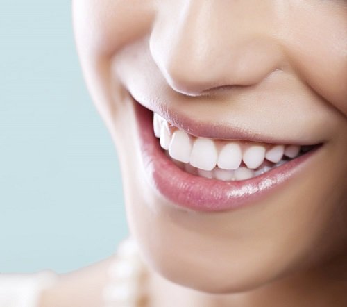 Những tác hại của việc tẩy trắng răng thiếu kiến thức nha khoa 1