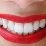Bọc răng hàm bị sâu có đau không? Tìm hiểu cách xử lý răng sâu