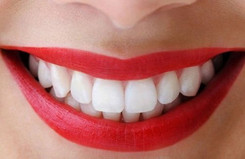 Bọc răng hàm bị sâu có đau không? Tìm hiểu cách xử lý răng sâu-1