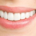 Bọc răng sứ giữ được bao lâu? Hiệu quả có cao không?