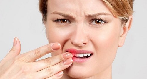 Răng bọc sứ bị lung lay phải làm sao? Cách xử lý từ nha khoa-1