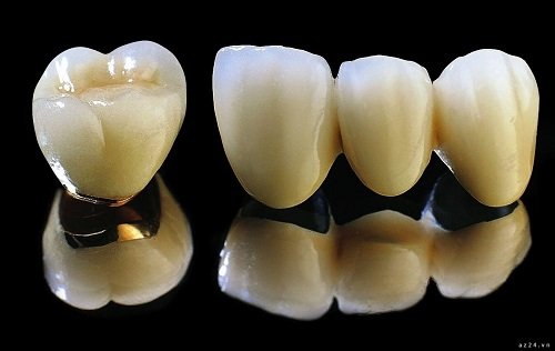 Răng sứ titan có bị đen không? Giải đáp thắc mắc-2
