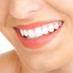 Răng sứ titan có mấy loại phổ biến nhất hiện nay?